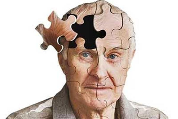 بیماری آلزایمر  (Alzheimer's disease)